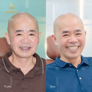 Slider image (1) WinSmile Dental Clinic Vietnam