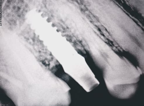 Slider image (3) Smiletec® - Leading Mexicali Dental Clinic