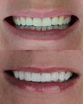 Slider image (1) Smile Atelier by Dr. Roberto Tamara - Dental Clinic in Colombia