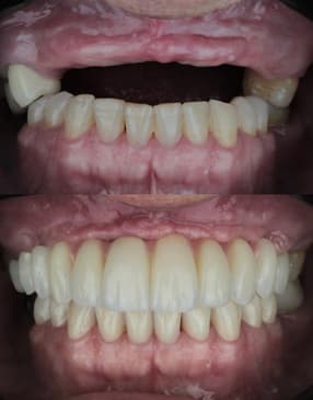 Slider image (2) Smile Atelier by Dr. Roberto Tamara - Dental Clinic in Colombia