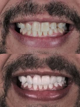 Slider image (3) Smile Atelier by Dr. Roberto Tamara - Dental Clinic in Colombia