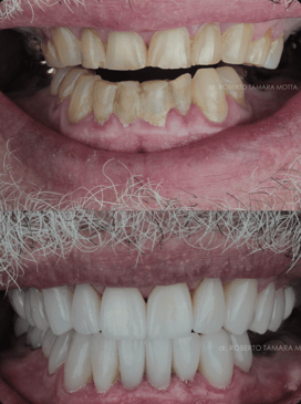 Slider image (4) Smile Atelier by Dr. Roberto Tamara - Dental Clinic in Colombia