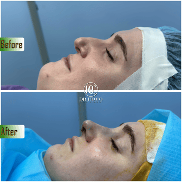 Slider image (5) Dr. Ho Co - Aesthetics and Plastic Surgery in Vietnam