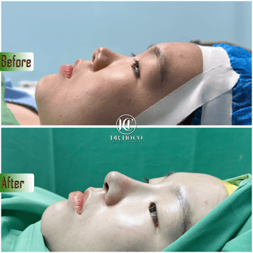 Slider image (3) Dr. Ho Co - Aesthetics and Plastic Surgery in Vietnam