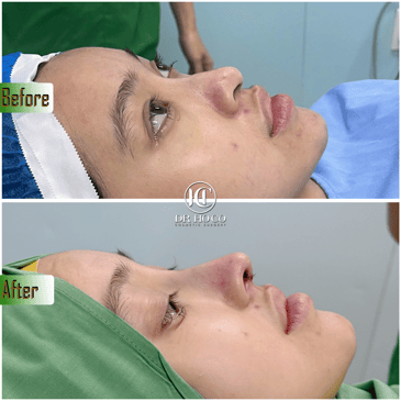 Slider image (4) Dr. Ho Co - Aesthetics and Plastic Surgery in Vietnam