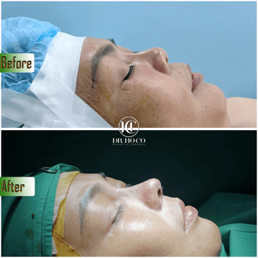 Slider image (6) Dr. Ho Co - Aesthetics and Plastic Surgery in Vietnam