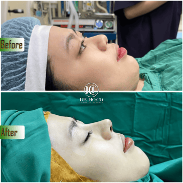 Slider image (7) Dr. Ho Co - Aesthetics and Plastic Surgery in Vietnam