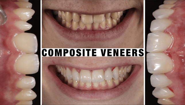 Slider image (5) CHC Clinica Dental in Barcelona Spain