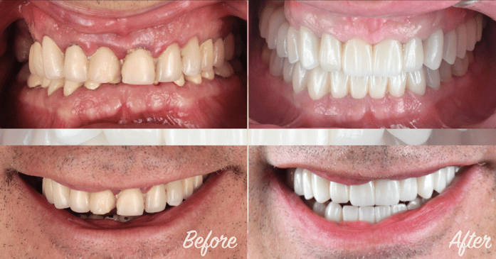 Slider image (6) CHC Clinica Dental in Barcelona Spain