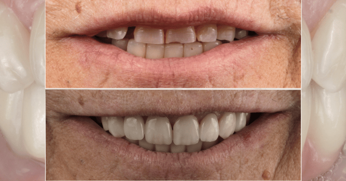 Slider image (7) CHC Clinica Dental in Barcelona Spain