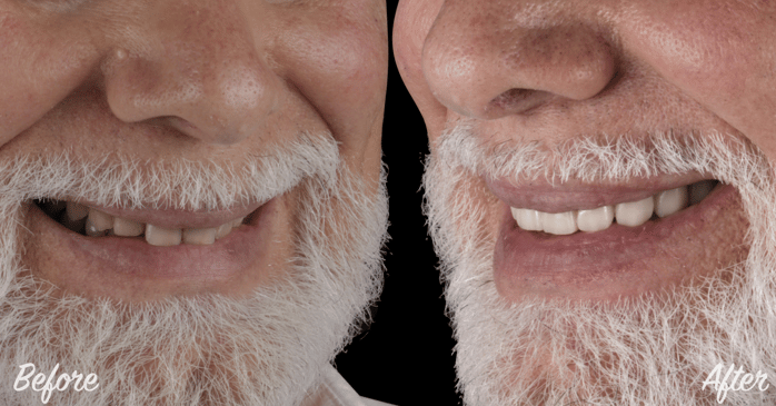 Slider image (8) CHC Clinica Dental in Barcelona Spain