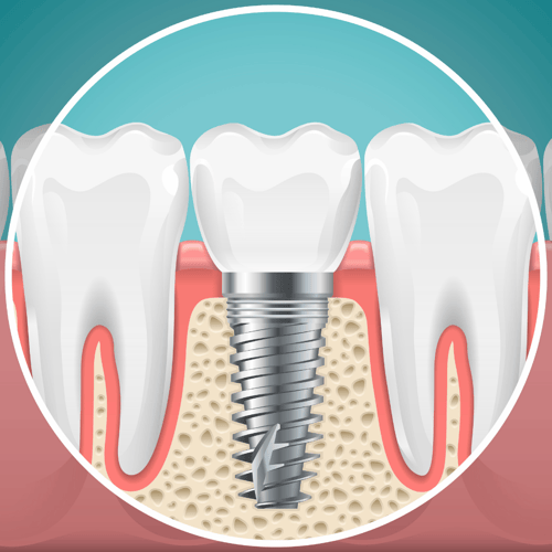 Marietta Dental Care
