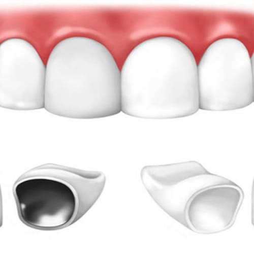 Americas Dental Care