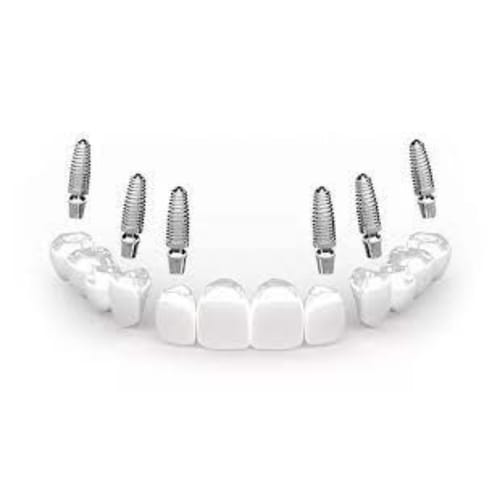 Sani Dental Group