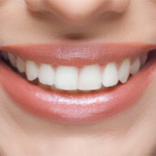 NEO Dental Group