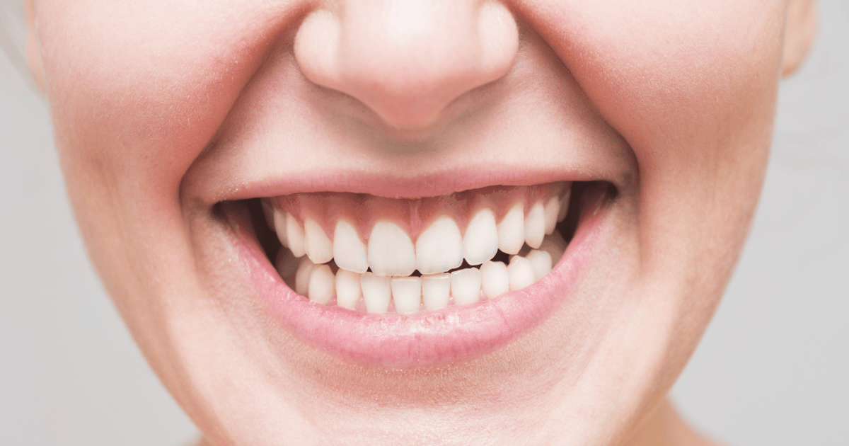 ¿Cuánto cuestan los implantes dentales en Colombia?