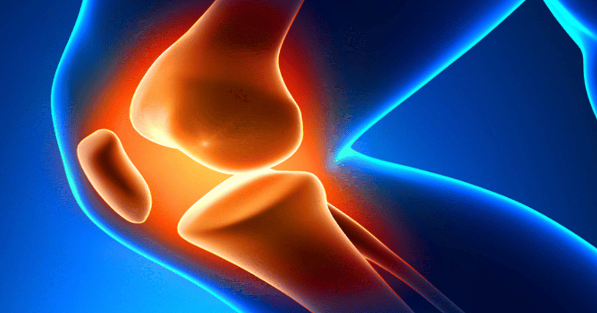 Los 3 países más baratos para la cirugía de reemplazo de rodilla