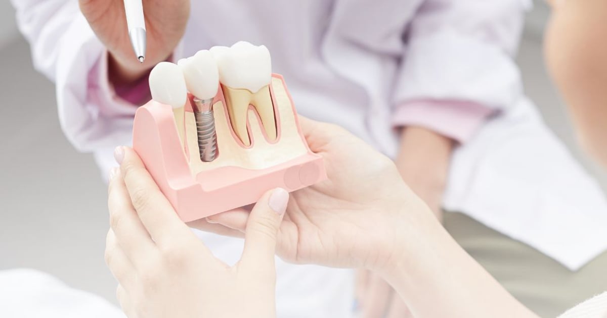 Dental Implants from Toronto to Los Algodones, Mexico – Save Big on Quality Dental Care