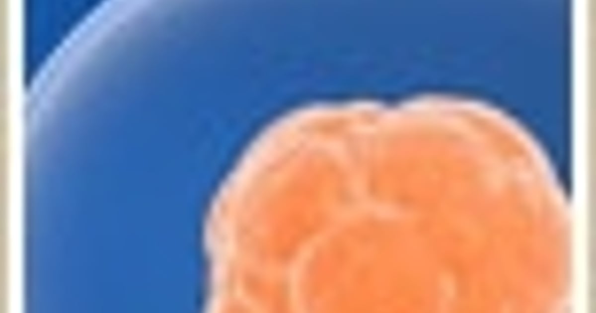Stem Cell Therapies May Help Restore Sight