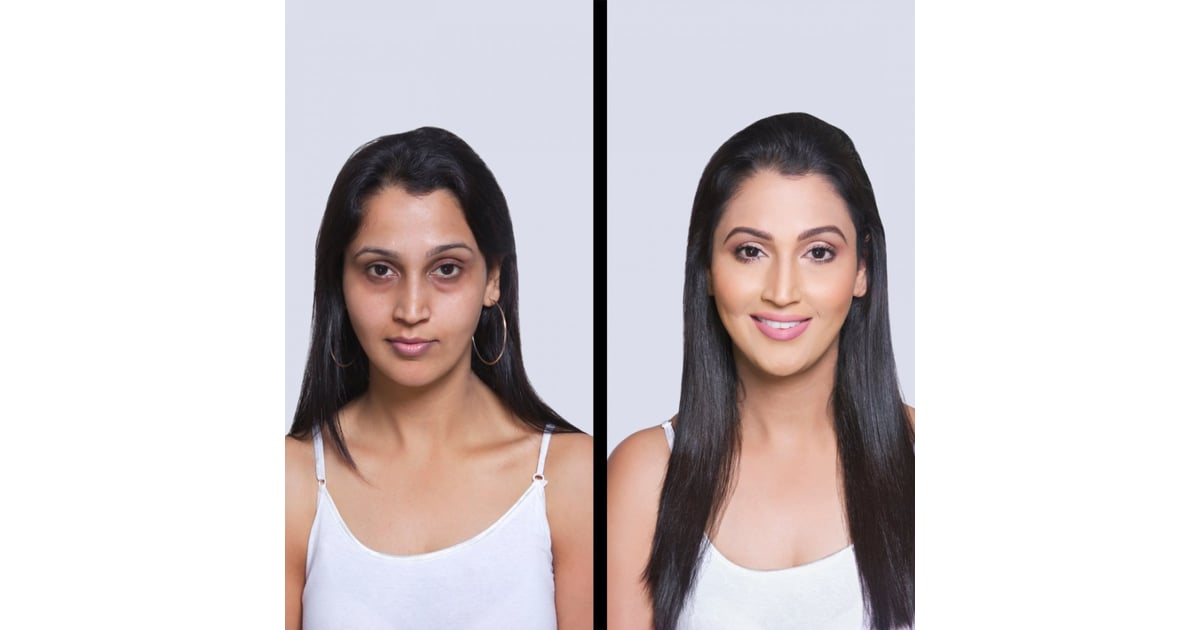Boost Patient Trust with Before and After Testimonials at PlacidWay