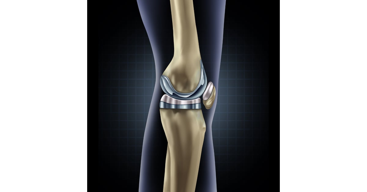 Total Knee Replacement Cost in Turkey: A Comprehensive Guide to Clinics, Reviews, and Packages