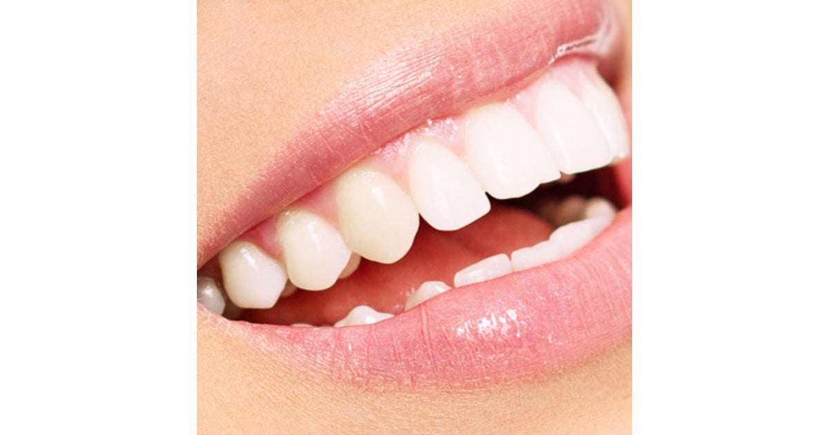 10 Best Dentists for Veneers in Tijuana Mexico