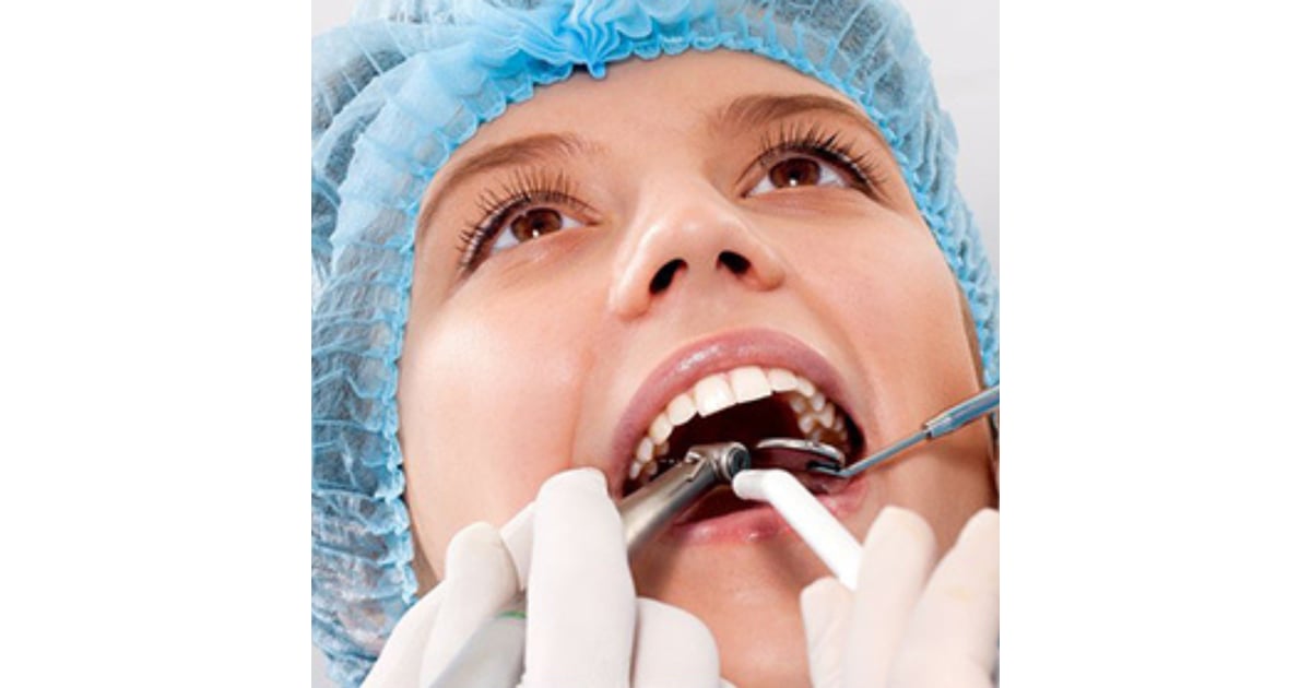 Dental Veneers in Mexico - Best Clinics, Dentists, and Packages
