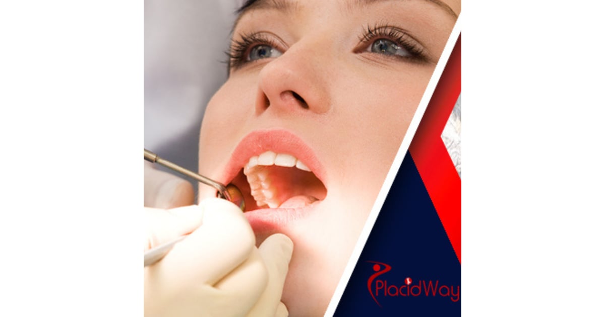 Things to Know about Gum Contouring in San Jose, Costa Rica