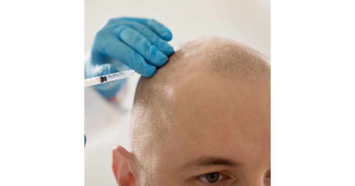 Best Countries for Hair Transplant Surgery in 2025