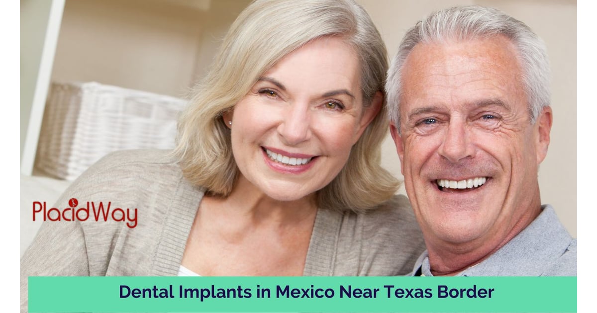 Implantes dentales en México cerca de la frontera con Texas: una opción conveniente