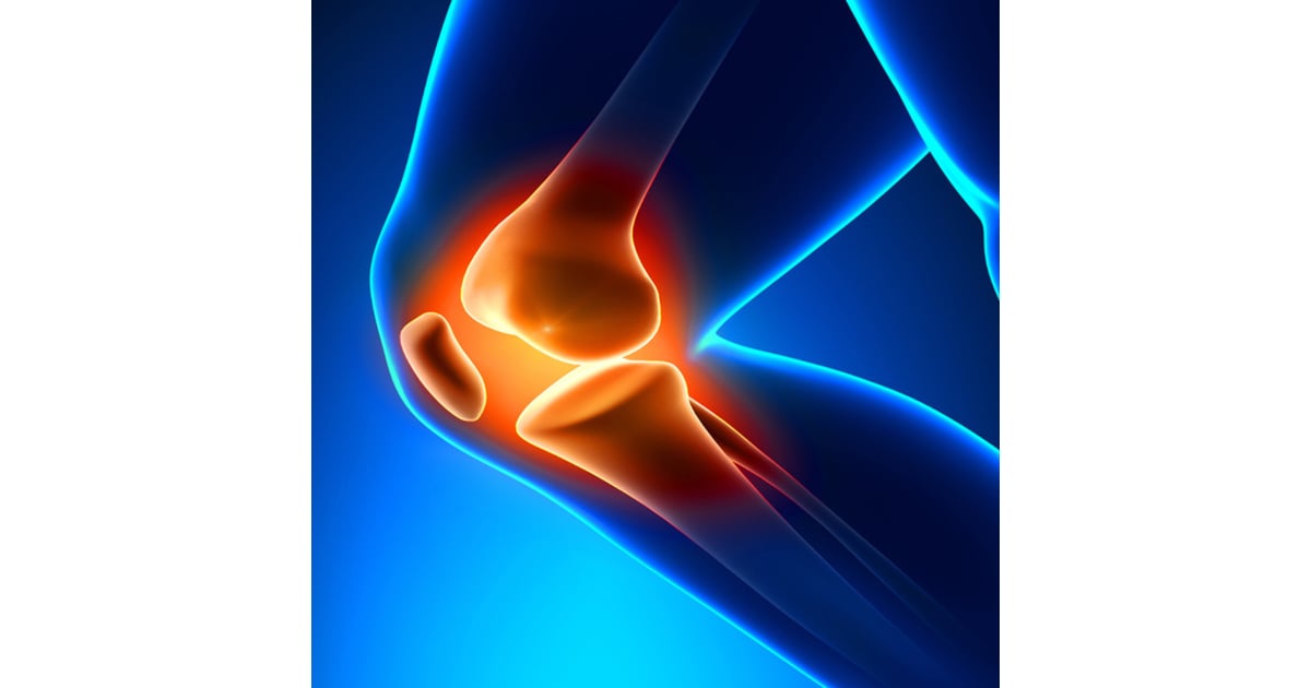 3 Cheapest Countries for Knee Replacement Surgery