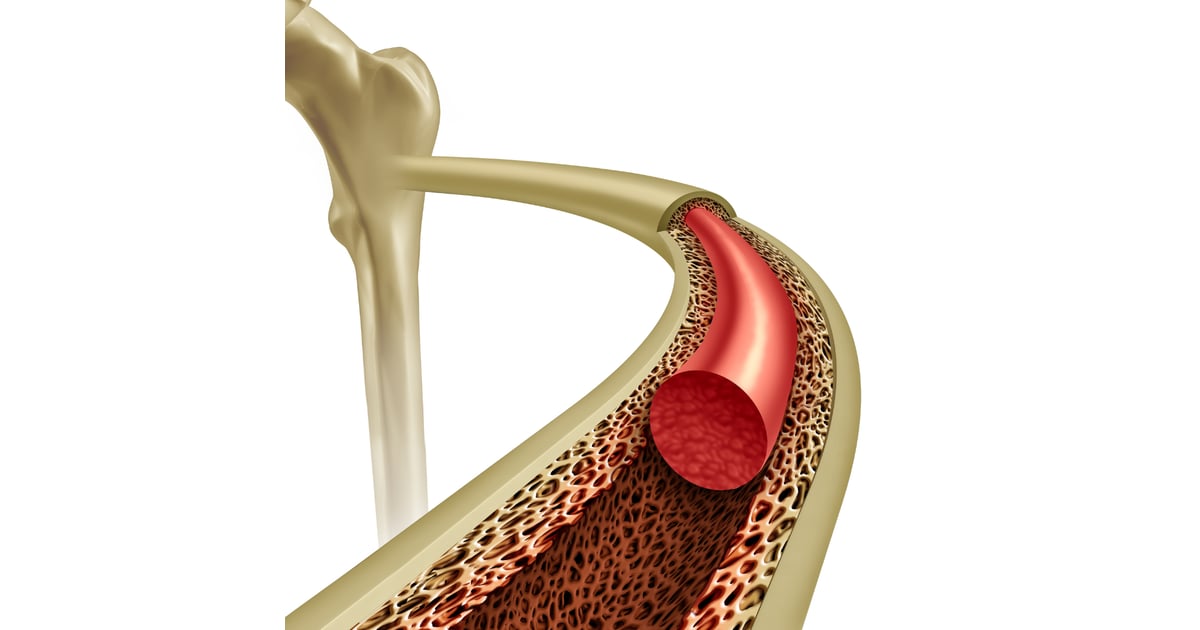 Bone Marrow Transplant Cost in Turkey 2025