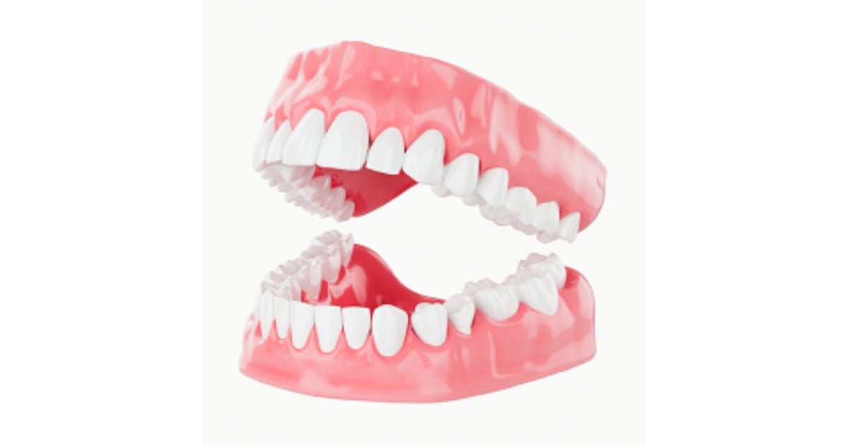 Implantes Dentales En Mexico Precios - 2024