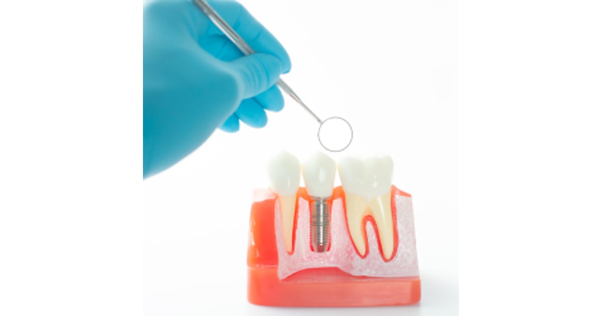 Mejores Clinicas Dentales en Estambul