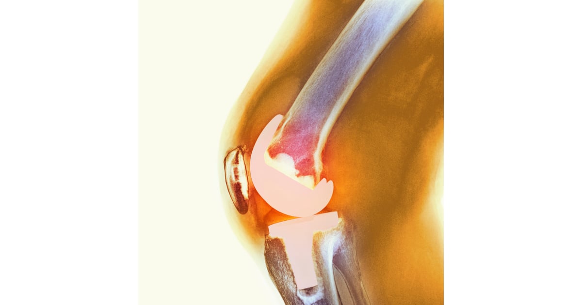 Best Knee Replacement Surgeons In The World