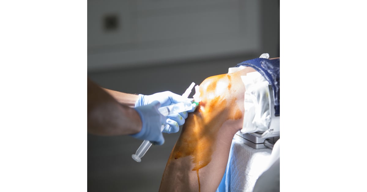 How Minimally Invasive Orthopedic Surgeries in Mexico are Redefining Recovery
