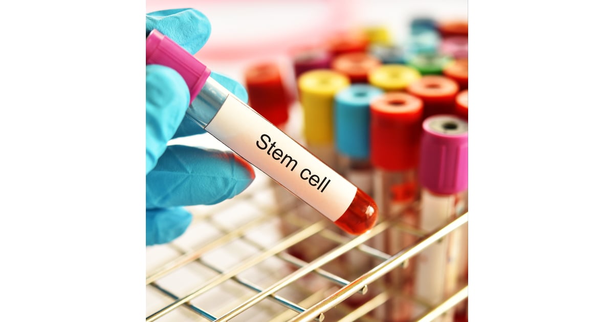 European Patients Seek Stem Cell Solutions for Orthopedic Conditions in the Czech Republic