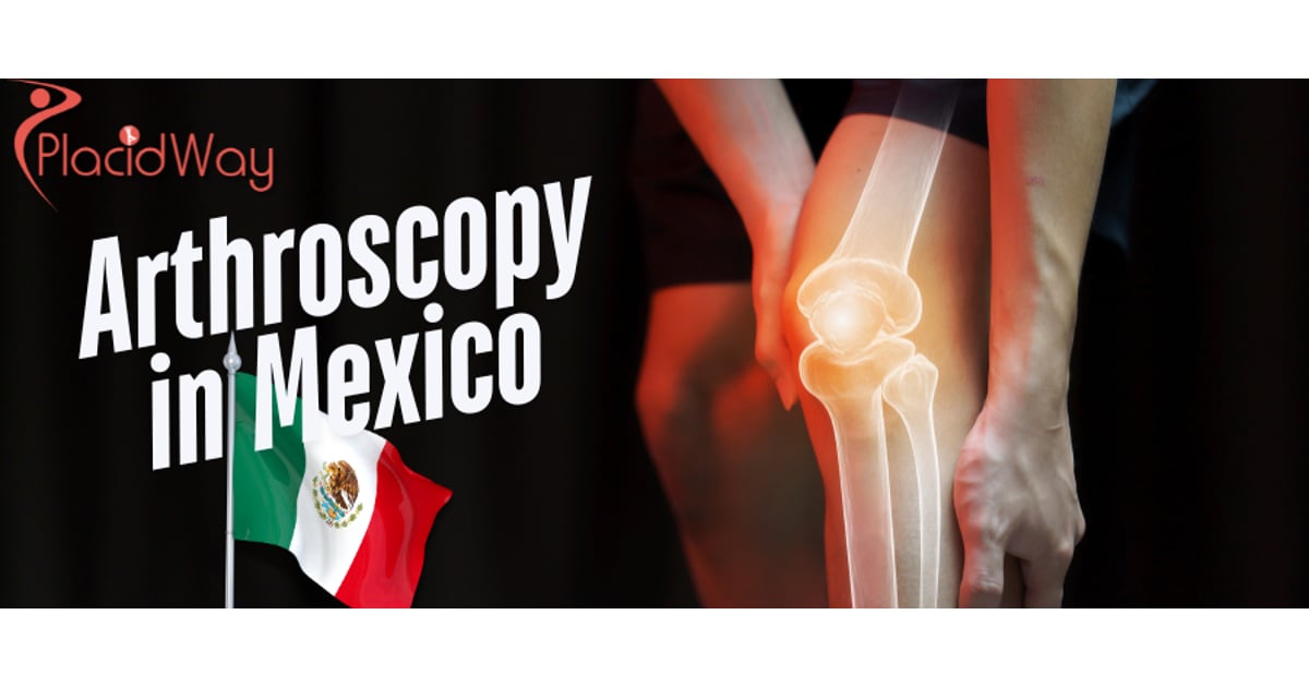 Arthroscopy in Mexico: A Minimally Invasive Option for Canadians