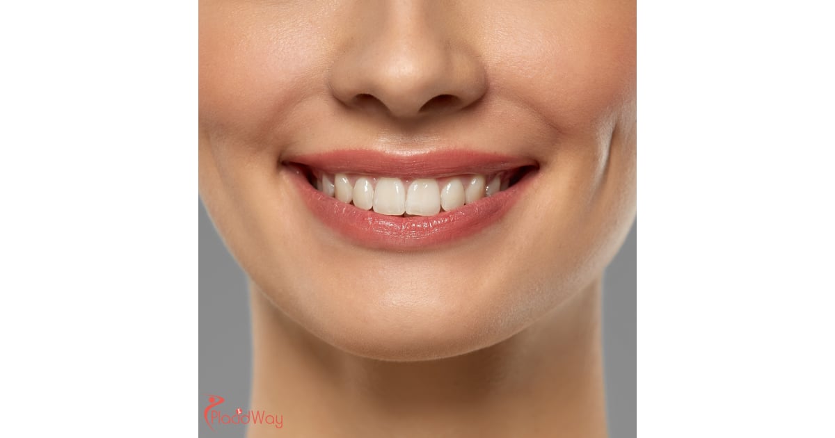 عملية تجميل الغمازات في جانجنام: أحدث جراحات التجميل في كوريا الجنوبية