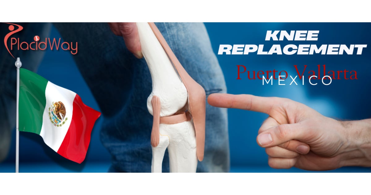 Knee Replacement in Puerto Vallarta, Mexico 2025
