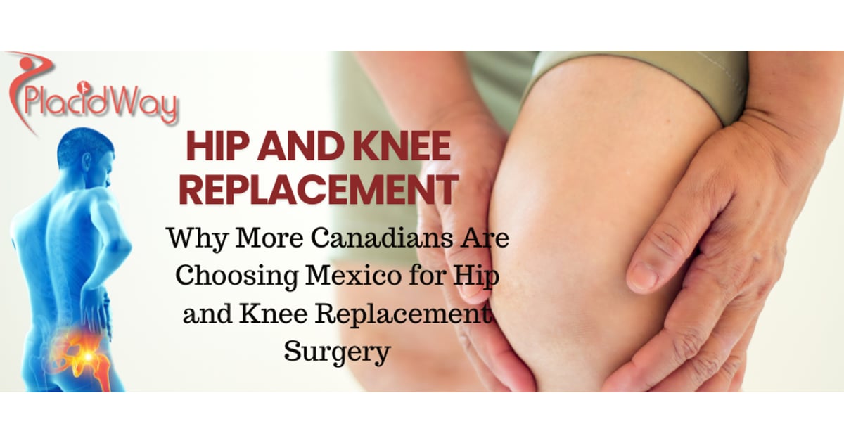 Why More Canadians Are Choosing Mexico for Hip and Knee Replacement Surgery