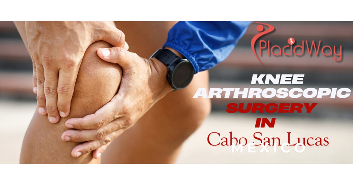 Complete Information on Knee Arthroscopic Surgery in Cabo San Lucas, Mexico