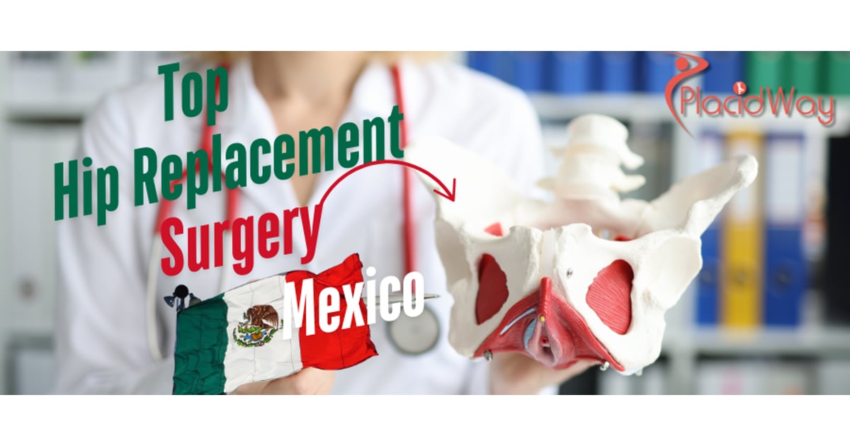 Why Mexico is a Top Destination for Hip Replacement Surgery?