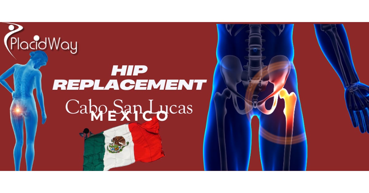 Hip Replacement in Cabo San Lucas, Mexico