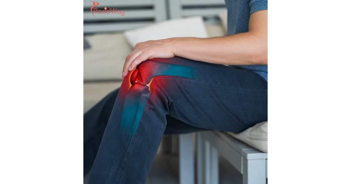 Exploring Stem Cell Solutions for Osteoarthritis: Why Canadians Are Heading to Mexico