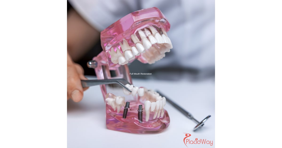 Full Mouth Restoration in Costa Rica: Affordable Solutions for a Perfect Smile