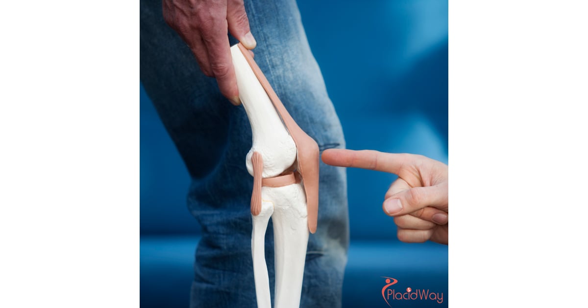 El mejor lugar del mundo para hacerse un reemplazo de rodilla