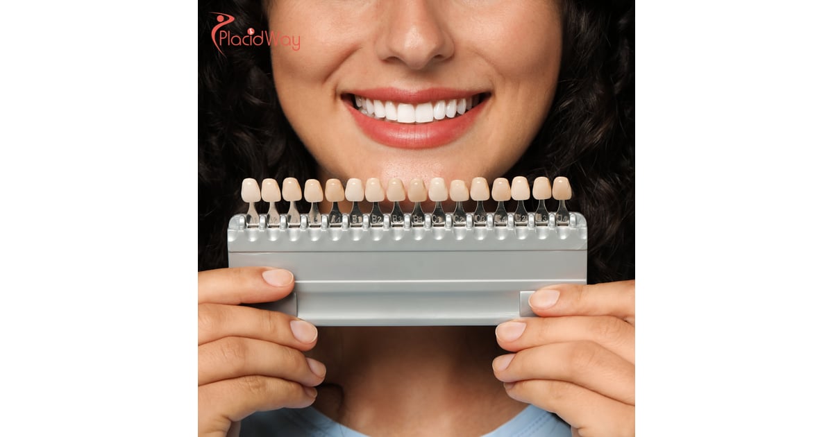 The Rise of Dental Tourism: What Australian Patients Need to Know About Getting Dental Veneers in Vietnam 
