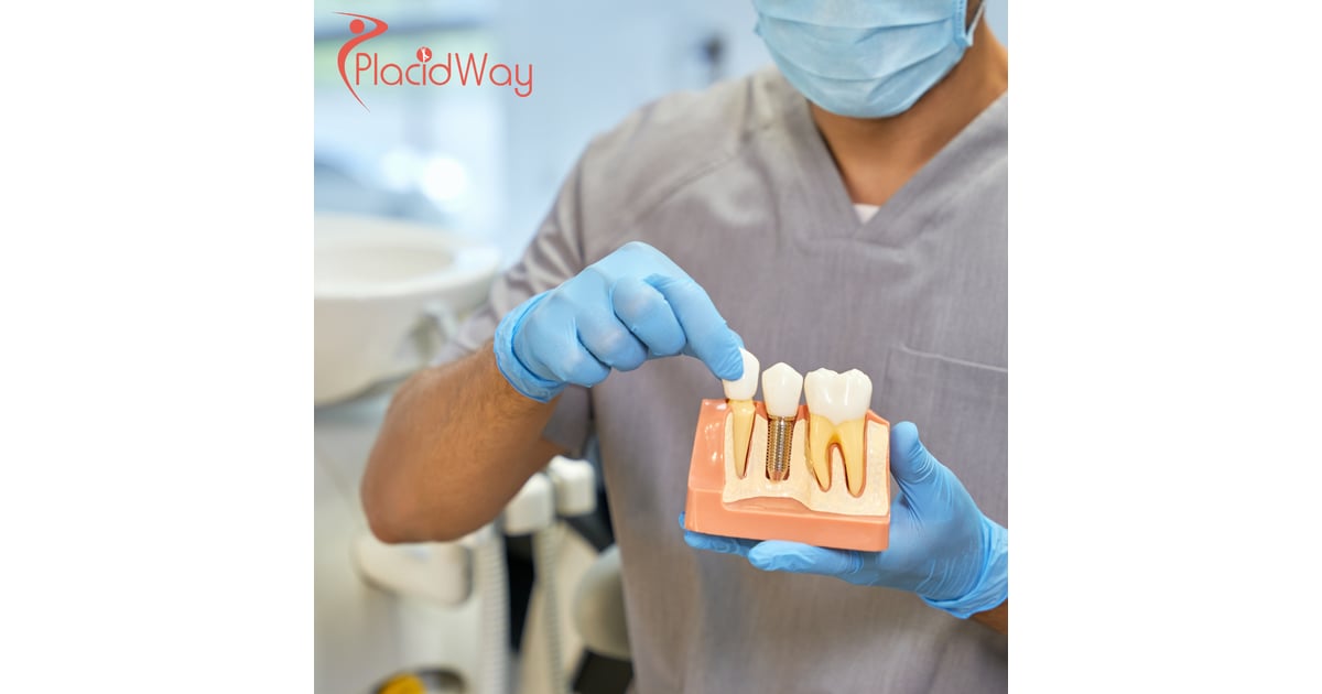 Affordable Dental Implants in Mexico: A Growing Trend Among Canadians
