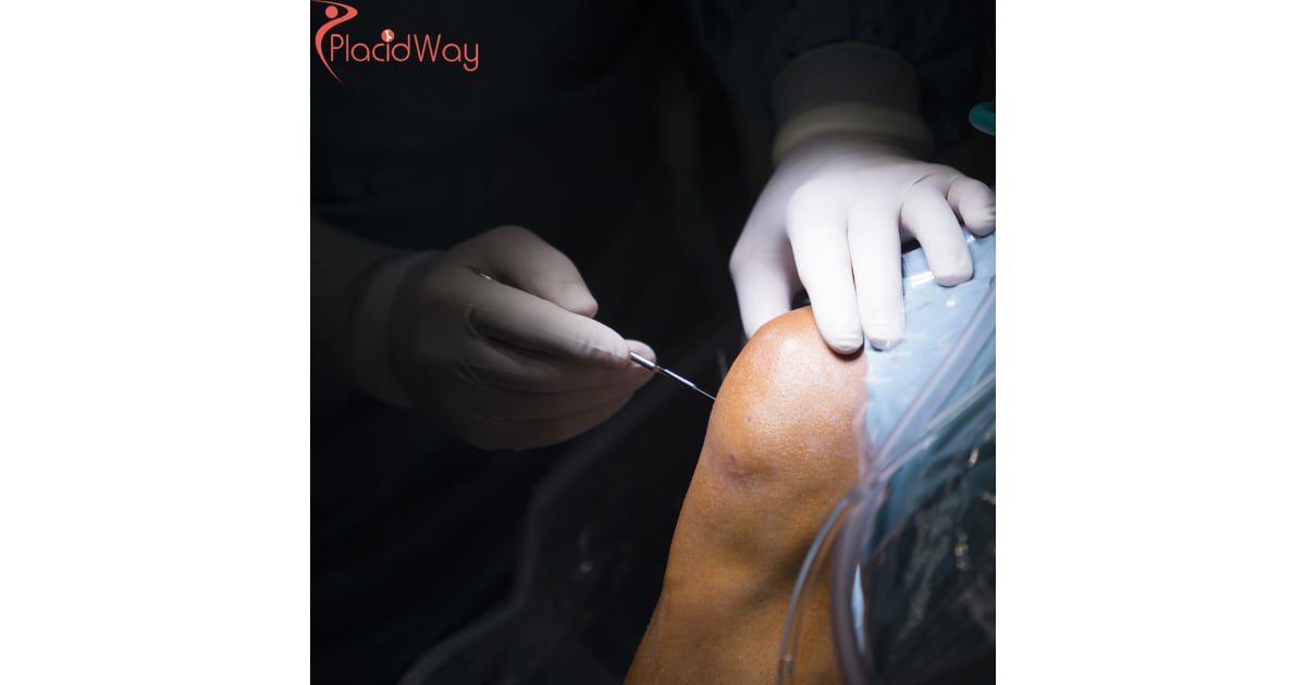 Affordable Stem Cell Therapy for Knee Injuries in Costa Rica: A Viable Option for Canadian Patients